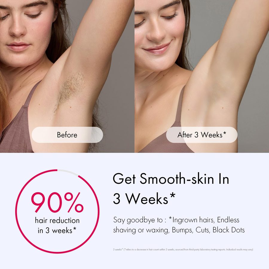 Ulike Air 3 IPL Laser Hair Removal Device