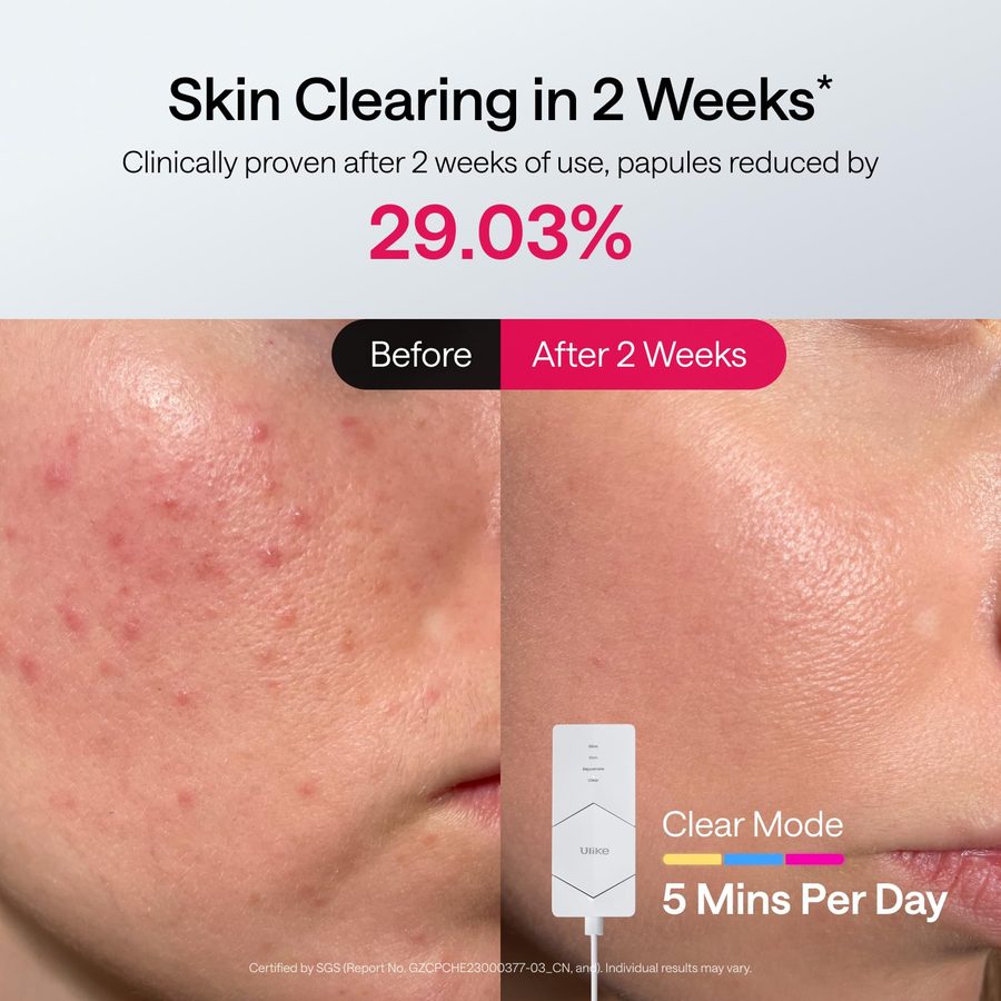 Ulike ReGlow LED Face Mask