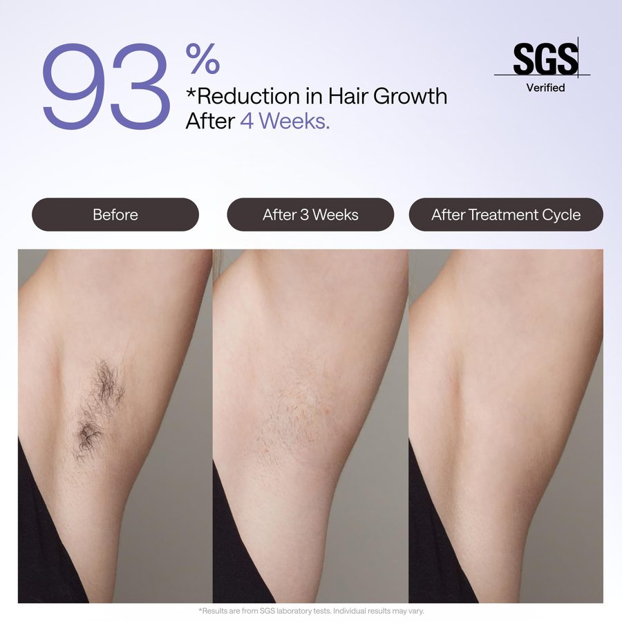 Ulike Air 4 IPL Laser Hair Removal Device